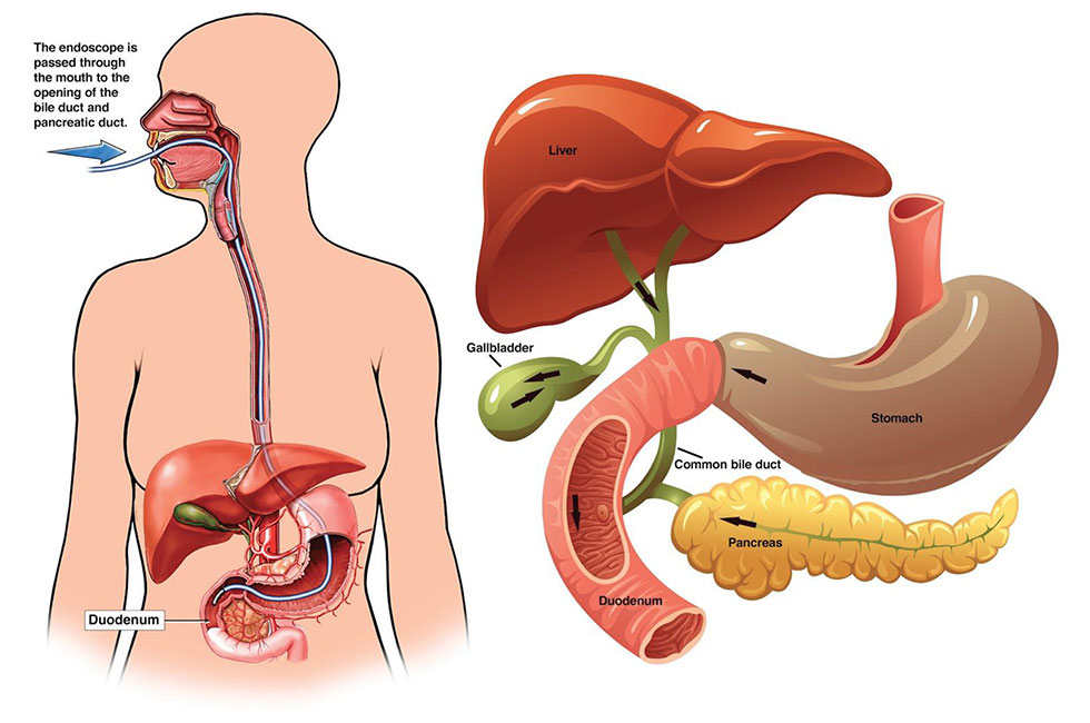 ERCP-page ERCP-page